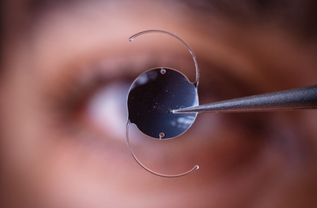 A close-up focusing on an artificial intraocular lens held by an eye doctor.